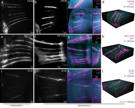 Comparing CLARITY-compatible lipophilic dyes for tracing and... | Download Scientific Diagram