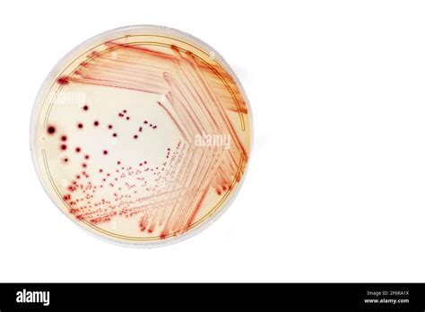 Escherichia coli petri Cut Out Stock Images & Pictures - Alamy