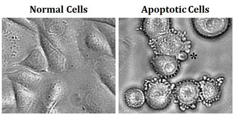 Mechanism of Apoptosis & its Significance | EasyBiologyClass