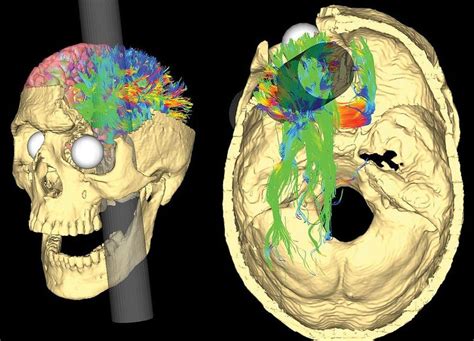 Psychophysiological Methods in Neuroscience | Noba