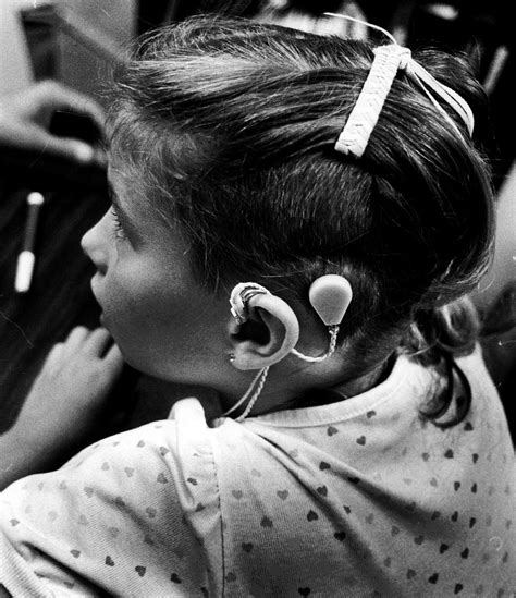 Deaf Culture and Cochlear Implants: Genocide or Salvation? | Time