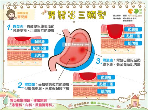 胃發炎三類型