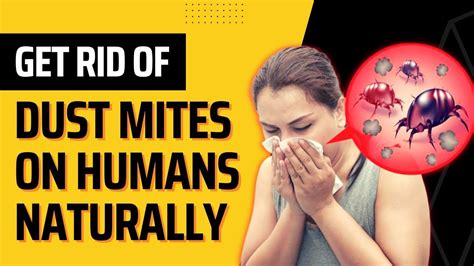 How to Get Rid Of Dust Mites On Humans Naturally (Fast Home Remedies) - Top Repellents - YouTube