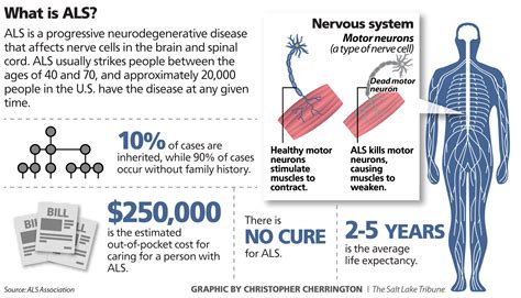 About Lou Gehrig's Disease: It's Rare, Debilitating And, 52% OFF