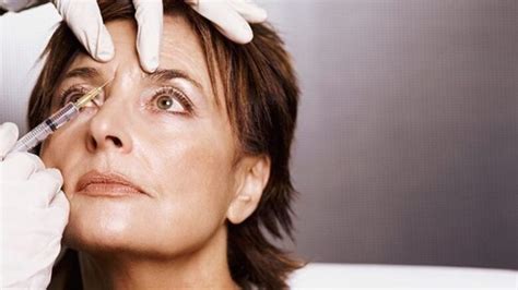 Botox Dos and Don’ts for Before and After Your Session - DemotiX