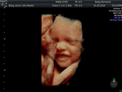 1000+ images about 3D 4D Ultrasound baby Scan Studio 08000075076 on ...