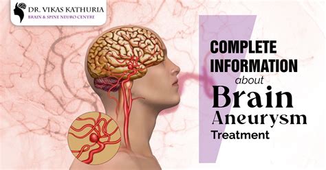 Best Brain Aneurysm Treatment Surgeon in Gurgaon