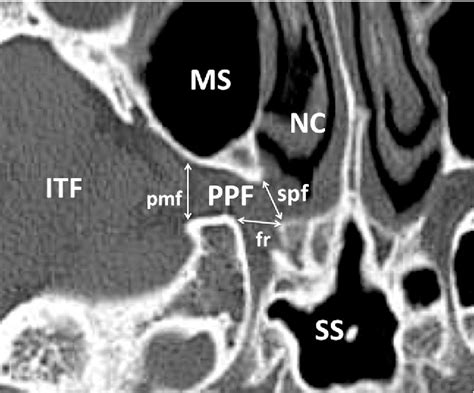 Get Ct Scan Brain Anatomy Pdf Background | Free Diagram Templates