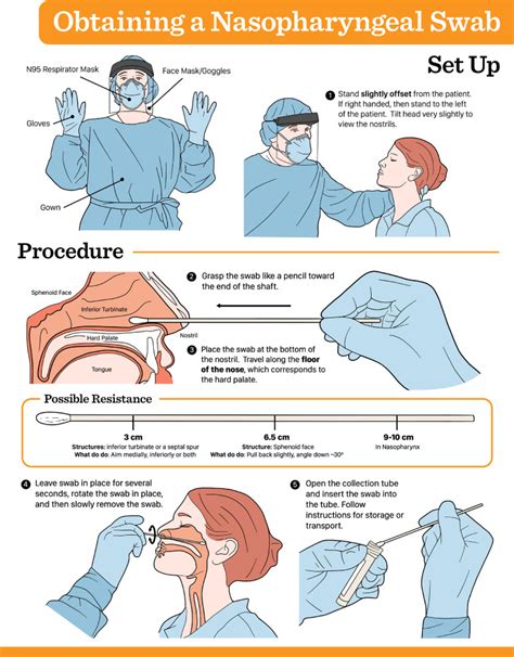 How to Perform a Nasopharyngeal Swab – An Otolaryngology Perspective - The American Journal of ...