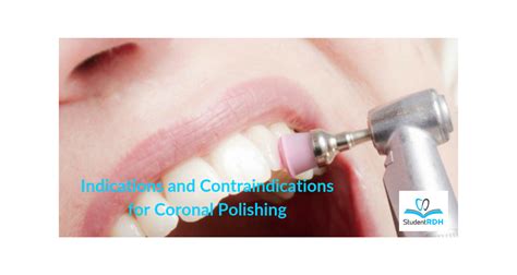 Explain the Difference Between a Prophylaxis and Coronal Polishing ...