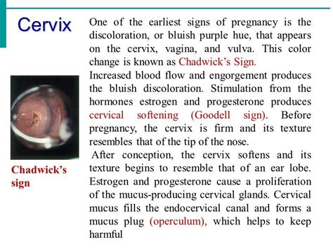 Chadwick's Sign | Pregnancy signs, Early pregnancy signs, Cervical mucus