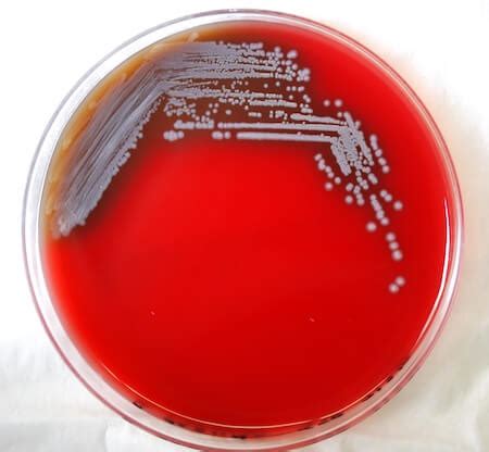 Fish Tank Granuloma and Other Waterborne Diseases