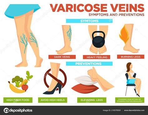 Varicose Veins Symptoms Preventions Poster Info Vector Heavy Feeling Burning — Stock Vector ...