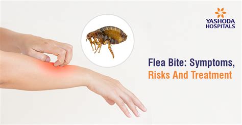 Flea Bite: Symptoms, Risks And Treatment