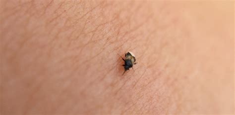 Little Black Bugs That Jump And Bite | Psoriasisguru.com