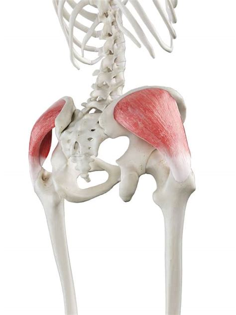 A Common Cause of Hip Pain : The Gluteus Medius