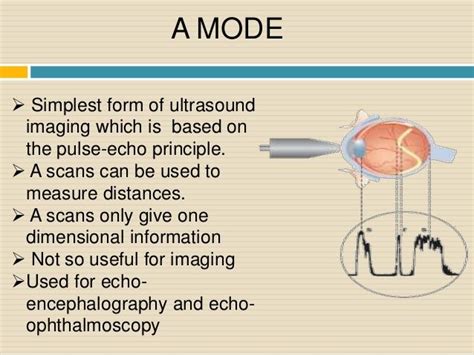 Ultrasound imaging | Ultrasound, Ultrasound physics, Diagnostic medical sonography