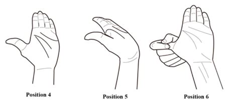 6 Exercises to Help Manage Carpal Tunnel Syndrome | Lifemark