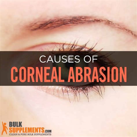 Corneal Abrasion: Symptoms, Causes & Treatment