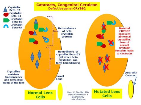 Cataracts, Congenital Cerulean | Hereditary Ocular Diseases