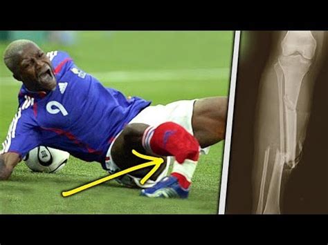 TOP 20 FOOTBALL TACKLES & INJURY | HD - YouTube