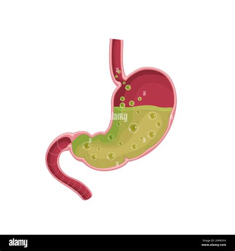 Stomach. Nausea. Diseases of the stomach. Vomiting Flat illustration ...