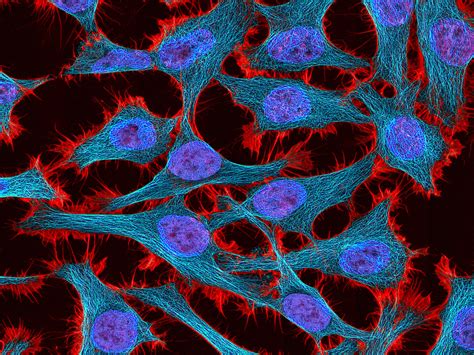 HeLa Cells: A New Chapter in An Enduring Story | NIH Director's Blog