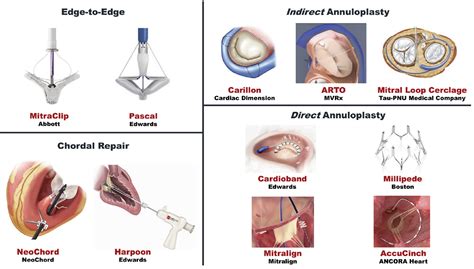 Patient selection for trans-catheter mitral valve repair vs ...