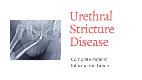 Male Urethral Stricture - Symptoms , Investigations and Treatment Guide I Bangalore - YouTube