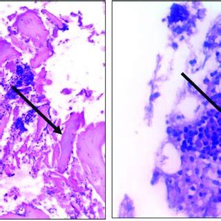 Histological structure of bone chips: a -magnification ×50; b ...