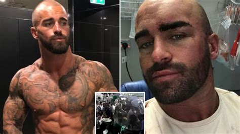 Horror moment OnlyFans bodybuilder is battered in head with metal stool during bar brawl leaving ...