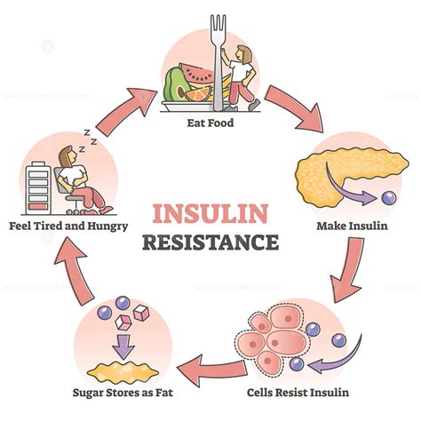 Insulin resistance pathological health condition educational outline ...