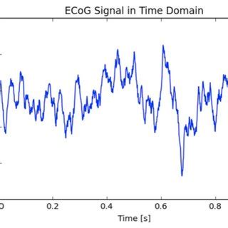 ECoG grid on cortical surface and ECoG signals. | Download Scientific Diagram