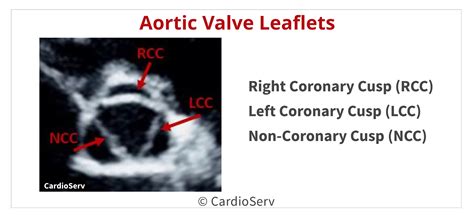 Back to the Basics: Aortic Valve Anatomy Cardioserv