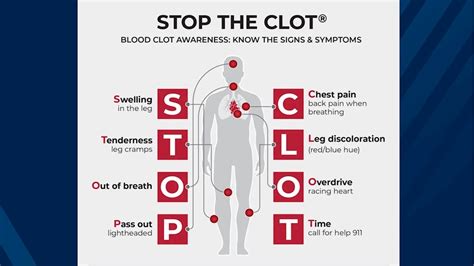 Knowing the symptoms of blood clots can be lifesaving | School of ...