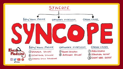 سنکوپ څه شی دی؟ لاملونه او درملنه Syncope | واسع کلینیک