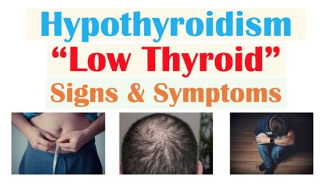 Hypothyroidism Symptoms Before And After