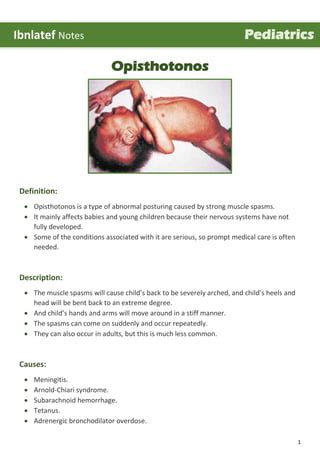 BAMS On X: Causes Of Opisthotonos 1- Meningitis 2- Tetanus, 54% OFF