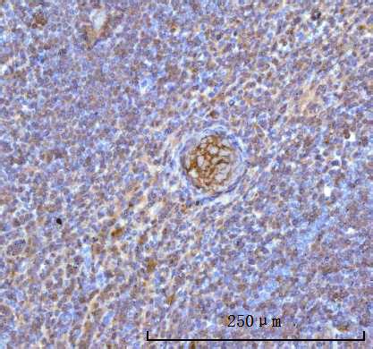 Hemoglobin/HBA1/HBA2 Antibody