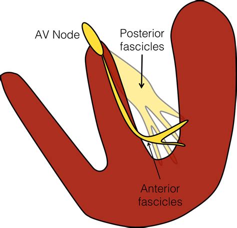 The Boring Guide to ECG's: Fascicular blocks - CanadiEM