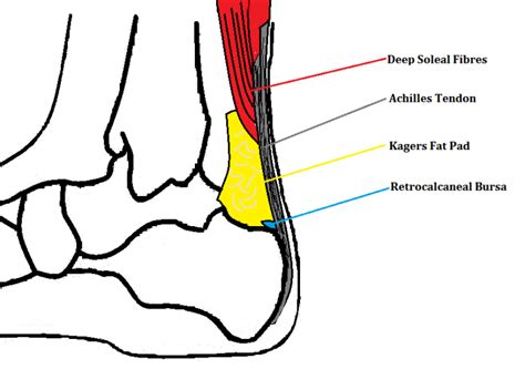 Kager's Fat Pad Irritation - Ankle, Foot and Orthotic Centre