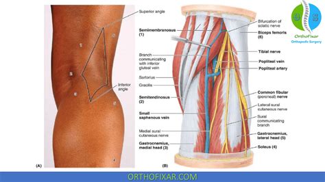 Popliteal Fossa | OrthoFixar 2024