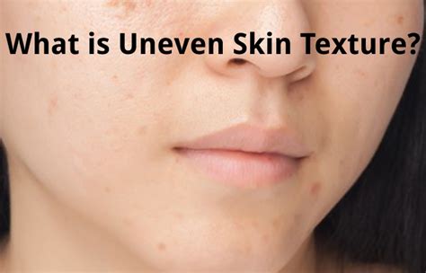 Textured Skin – Definition, How to Get Rid, and More