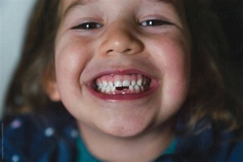 Little Girl Showing Two Missing Teeth by Giorgio Magini - Baby Tooth, Dentition in 2021 | Girls ...