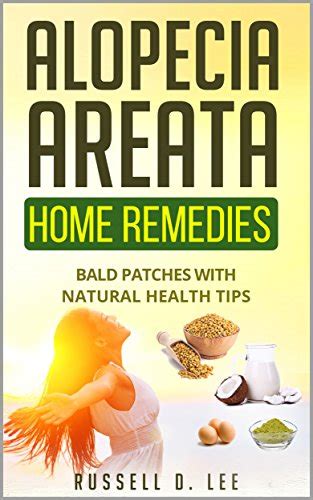 Alopecia: Alopecia Areata Home Remedies…Bald Patches With Natural ...