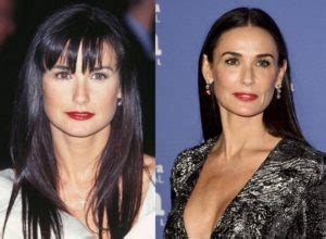 Demi Moore Before and After Plastic Surgery: Face, Boobs, Nose