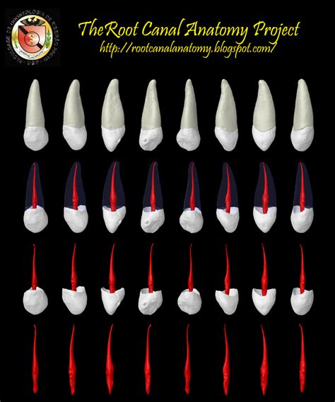 The Root Canal Anatomy Project: Maxillary Canine