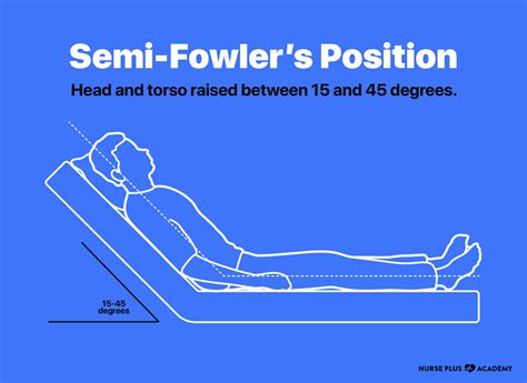 Semi-Fowler's position | Nurse Plus