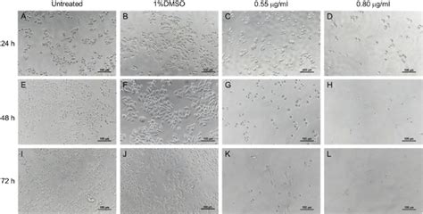 Effects of GHR on SW480 cell morphology. SW480 cells were treated with ...