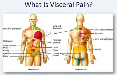 Symptoms of Visceral pain - Hill Regional Hospital - Medium